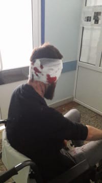 Дмитрий Булах сразу после нападения