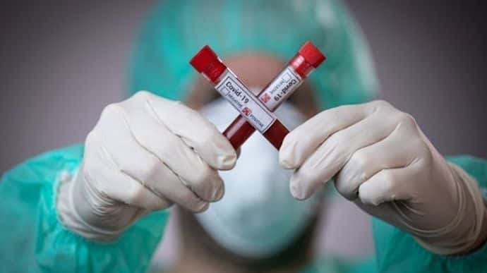 Украинцев начали тестировать на антитела к коронавирусу
