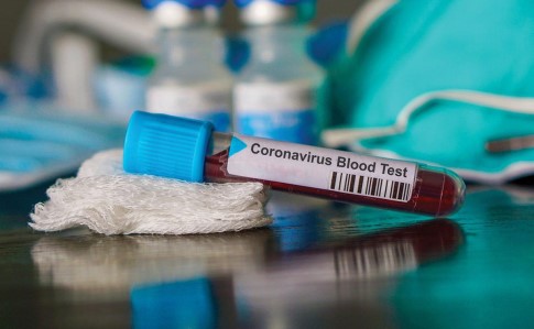 Відступ пандемії на Сумщині: жодного нового випадку коронавірусу за добу