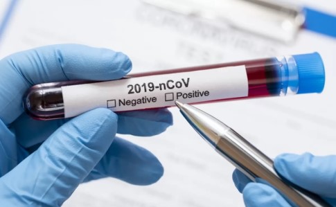 В Украине выявили уже почти 900 зараженных коронавирусом