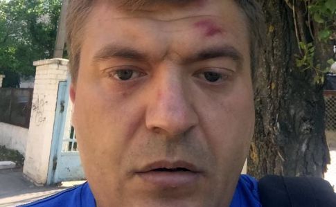 Побитый херсонский журналист узнал нападвших на него