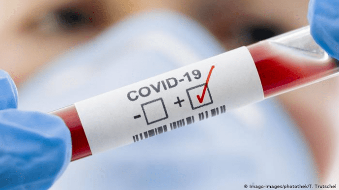 Понад 9 тисяч людей за добу померли від COVID-19