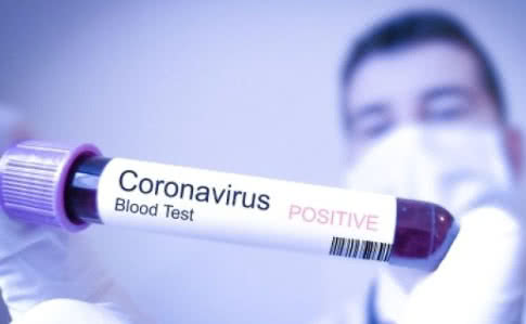 В Україні вже 41 випадок захворювання на Covid-19