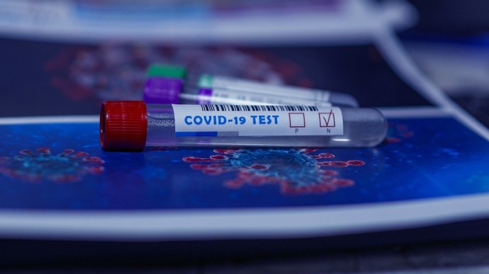 Щоденна захворюваність на Covid-19 в Україні впала нижче 400 випадків