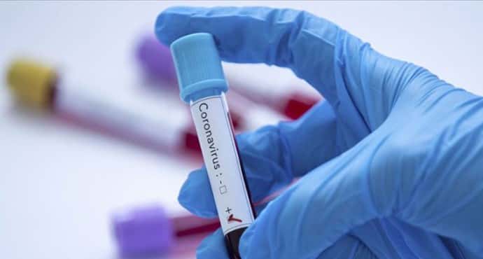 На Буковине снова более 50 заражений коронавирусом за сутки