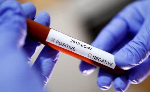 Во Франции подтвердили пять новых случаев заражения коронавирусом