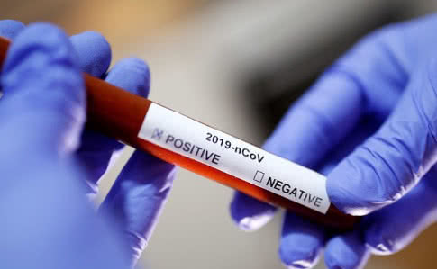 Госструктуры закупили через Prozorro 15 тысяч тестов на коронавирус