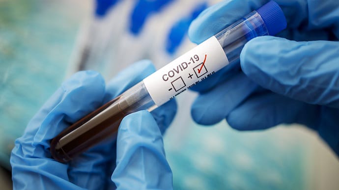 Украина вернулась в 5-ку лидеров в Европе по распространению коронавируса
