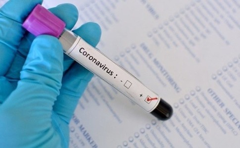 В Житомирской области три дня подряд фиксируют уменьшение случаев COVID-19