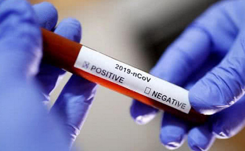 Україна тестуватиме громадян на коронавірус системами російського походження – нардеп