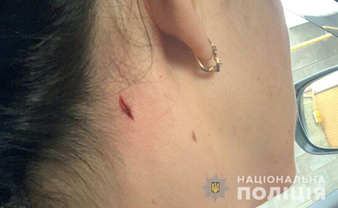 Женщина заявила о ранении шеи возле полицейского стрельбища