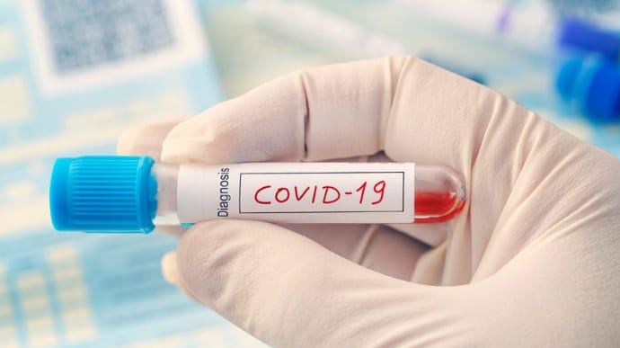 В Байдена упрекнули Китай за нежелание установить источник происхождения COVID-19