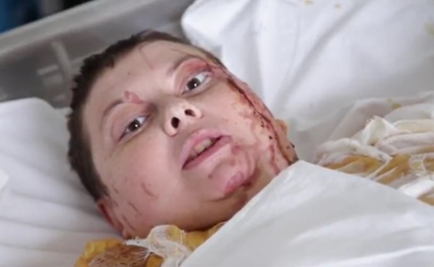 Гандзюк звернулася до влади просто з лікарняного ліжка: опубліковано відео