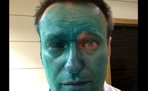 Навальний розповів про алергію, якої у нього ніколи не було