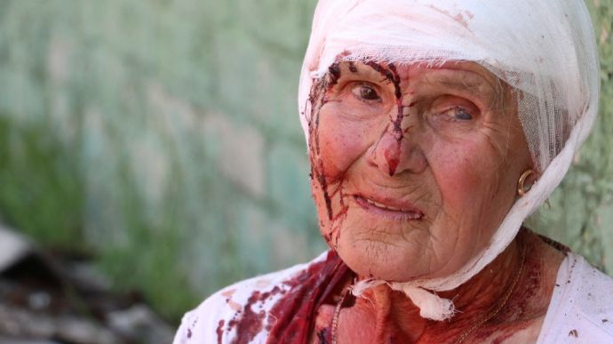 Постраждалих на Київщині вже шестеро: поранено бабусю, підліток врятувався у підвалі