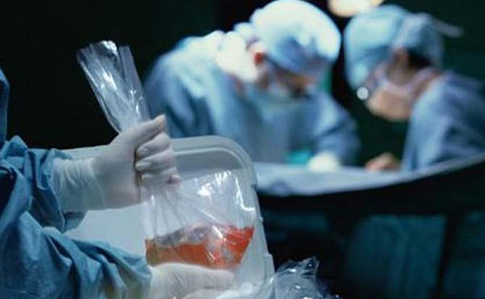 В Украине утвердили стоимость трансплантации органов