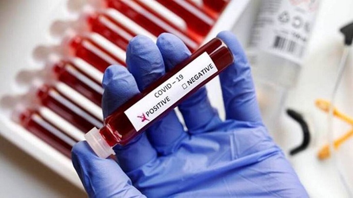 Британия зафиксировала самое высокое количество случаев коронавируса с конца января