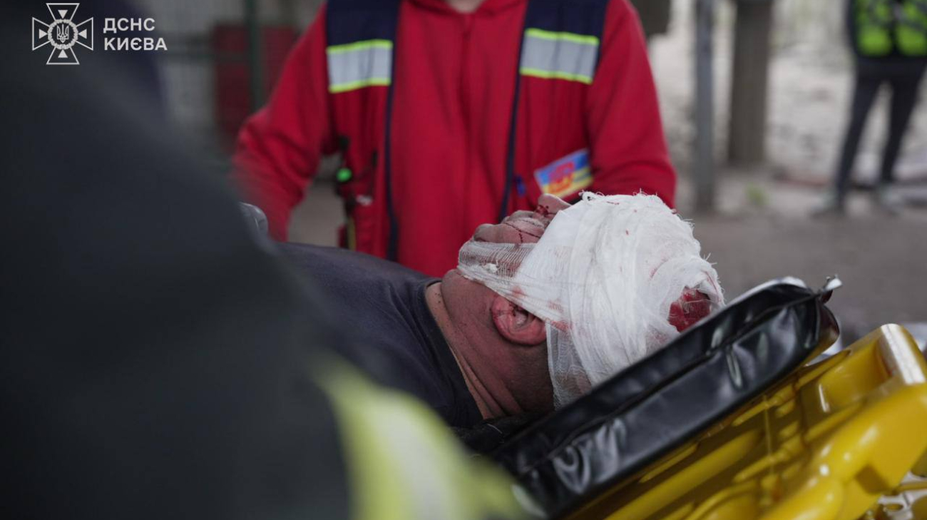 Killed nurse and patient, another 70 people are injured - the head of the Ministry of Internal Affairs about the consequences of the Russian attack thumbnail