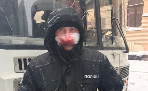 МВД: под Радой пострадали 7 полицейских