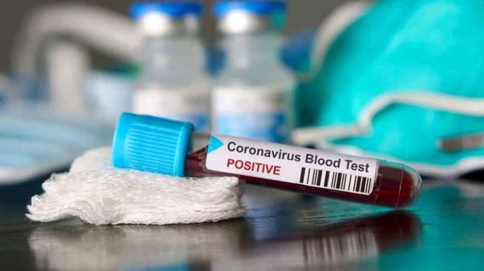 В воскресенье COVID обнаружили у 8 346 украинцев, прививки сделали 1 585 гражданам