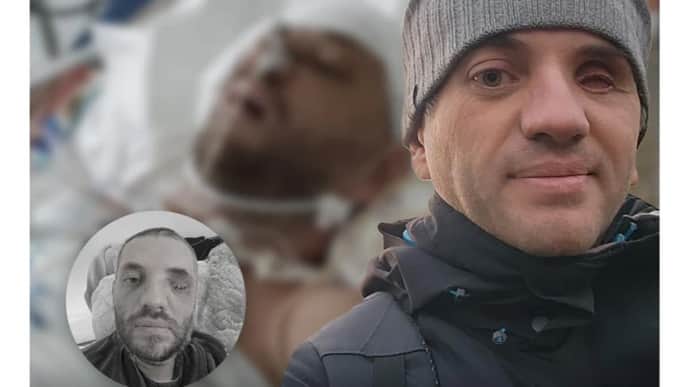 Shrapnel hit my eye, shattered my skull bones and damaged my brain: how one Ukrainian soldier was saved