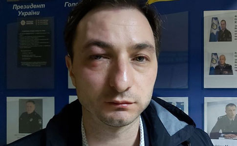 В Киеве напали на главврача Института рака