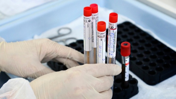 На Житомирщині за день підтвердили 2 випадки зараження коронавірусом