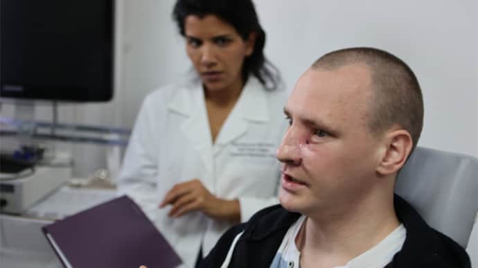 Doctors restore face of wounded soldier with broken skull and hole under eye – photo