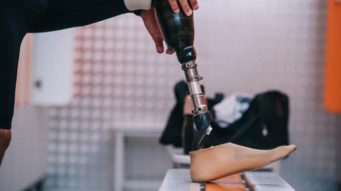 Ukrainian State Prosthetics Programme: how many people received prostheses in 2024, and what changes are coming soon