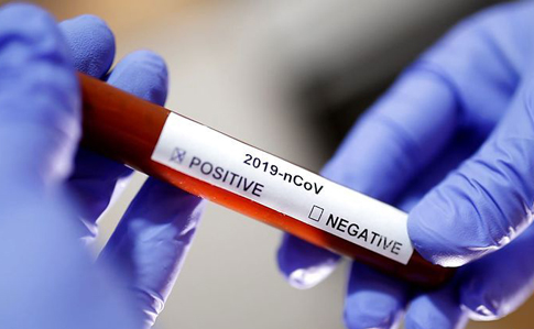 Минздрав закупил тесты на коронавирус для более 90 000 человек