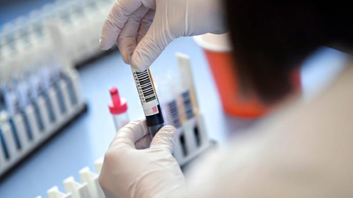 У Словаччині засумнівались у ефективності масового тестування на коронавірус
