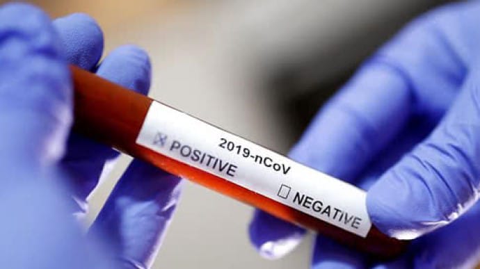Вчені: Коронавірусом можна заразитися повторно