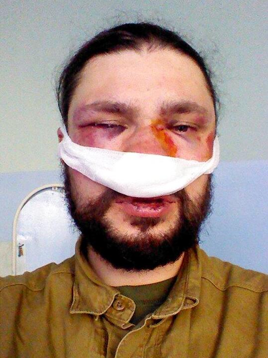 Максим Требухов в Александровской больнице после избиения, февраль 2014 года
