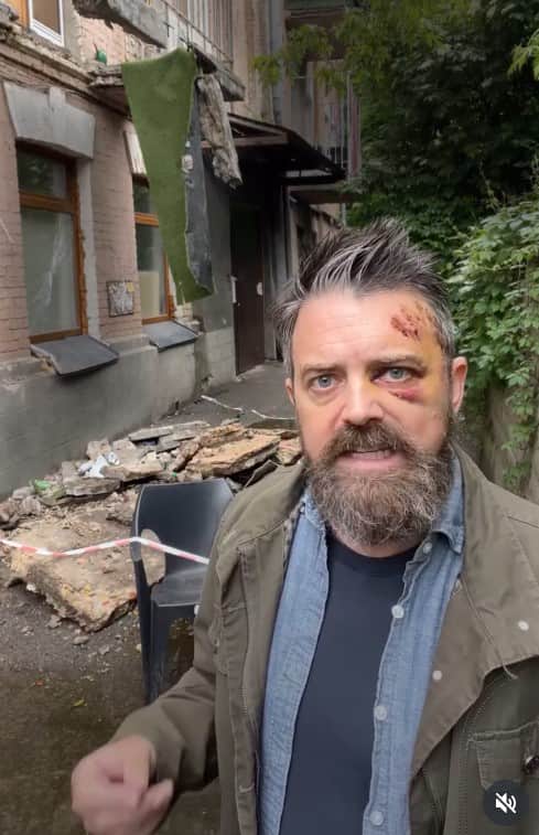 A balcony collapsed under an American journalist in Kiev