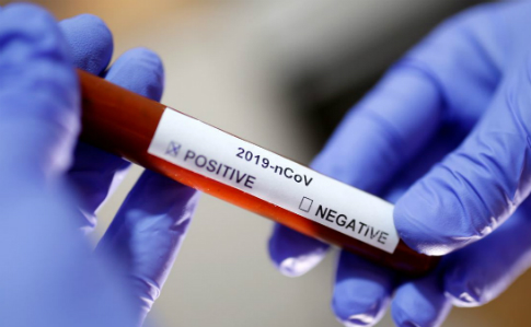 На Тернопільщіні вже 4 випадки коронавірусу – місцева влада