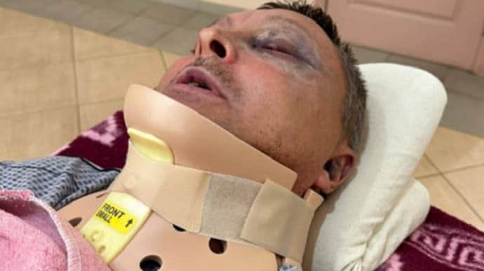 Під Одесою напали на військового: в нього перелом шиї – ЗМІ