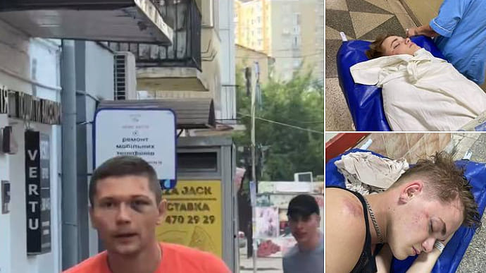 Перед судом постане екс-УДОшник, який побив танцівника Дорофєєвої