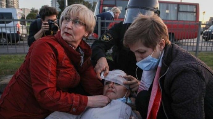 Протести у Білорусі: Чехія прийняла на лікування десятки постраждалих мітингувальників