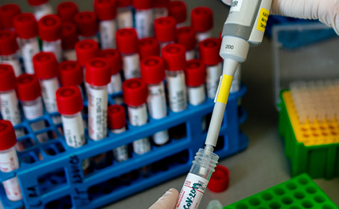 Украина закупит реагенты на проведение 1 млн тестов на коронавирус