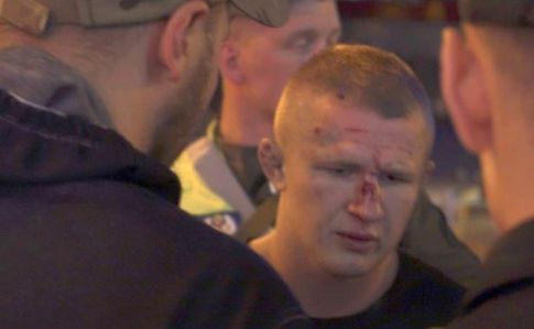 Полиция Киева: в драке пострадали двое иностранцев, двоих задержали