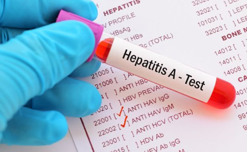 Вспышка гепатита А в школе Чернигова: госпитализированы 12 школьников