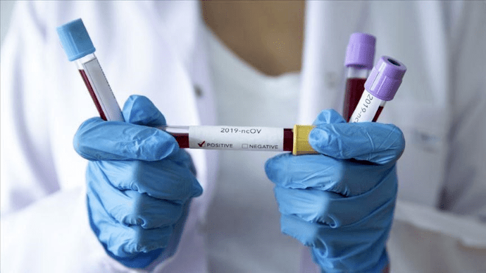Украина – 4-я в Европе по суточной смертности от коронавируса