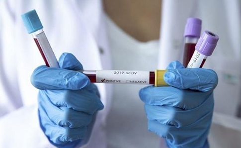 Аналізи українця з коронавірусом відправлять для підтвердження в Лондон