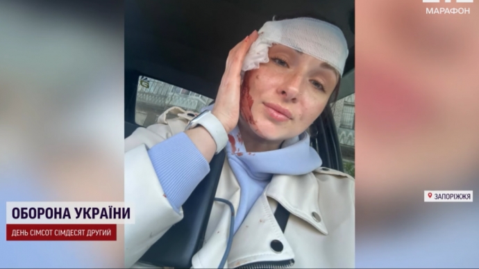 Ukrainian journalists injured in Russian strike on Zaporizhzhia – photo, video
