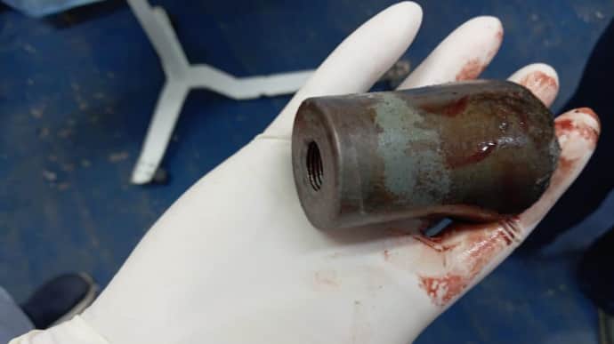 Doctors extract unidentified cluster munition from Ukrainian defender's leg at field hospital – photo