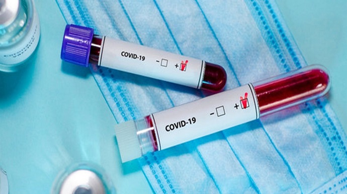 COVID-19 у світі: кількість хворих перевищує 15 мільйонів