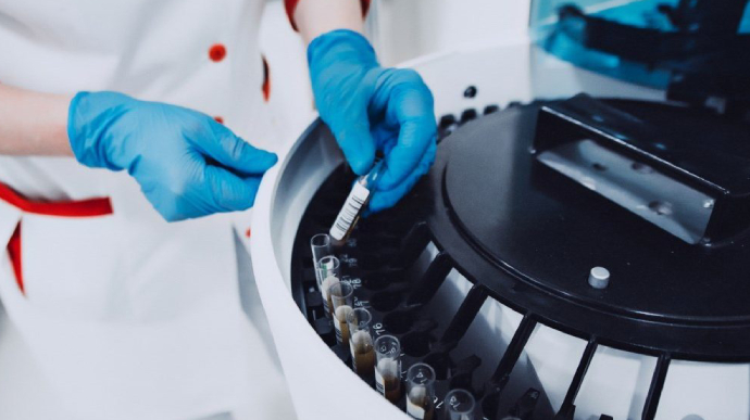 Коронавірус: лабораторія Житомира завантажена і не прийматиме матеріали 3 дні