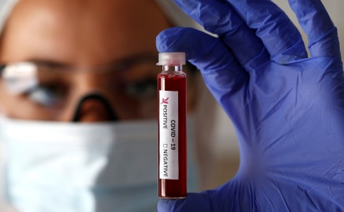 На Буковині виявили 87 нових заражень коронавірусом