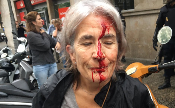 В сети распространяют фото раненых в столкновениях с полицией каталонцев