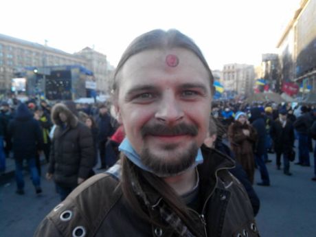 Алексею Быку попали в лоб, он в норме